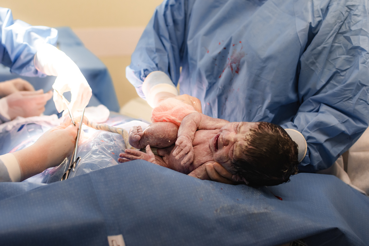 foto de aprto em natal rn - bebê nasceu