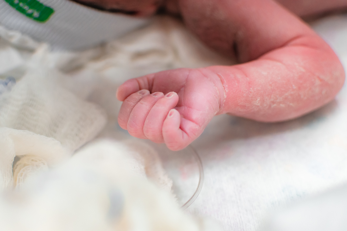 foto de parto em natal rn - detalhes do bebê