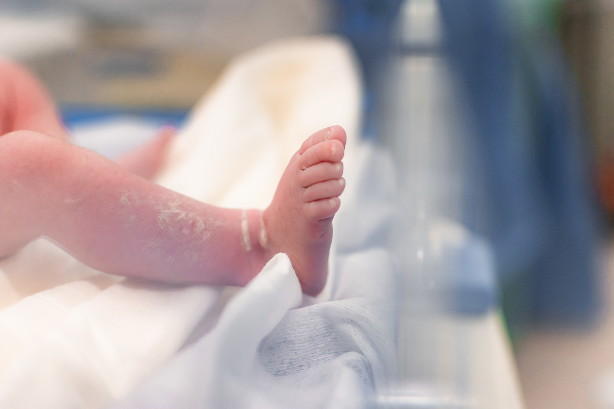 foto de parto em natal rn - detalhes do bebê