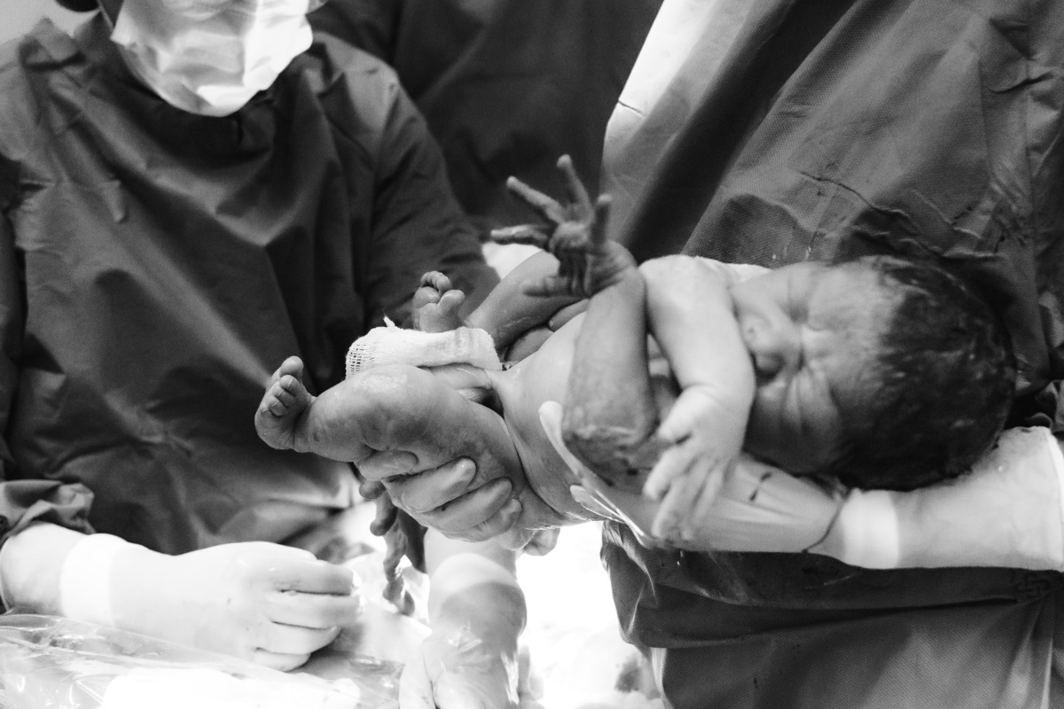 foto de parto em natal rn - o bebê nasceu