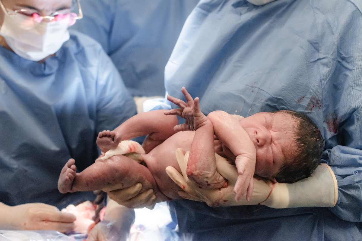 foto de parto em natal rn - o bebê nasceu