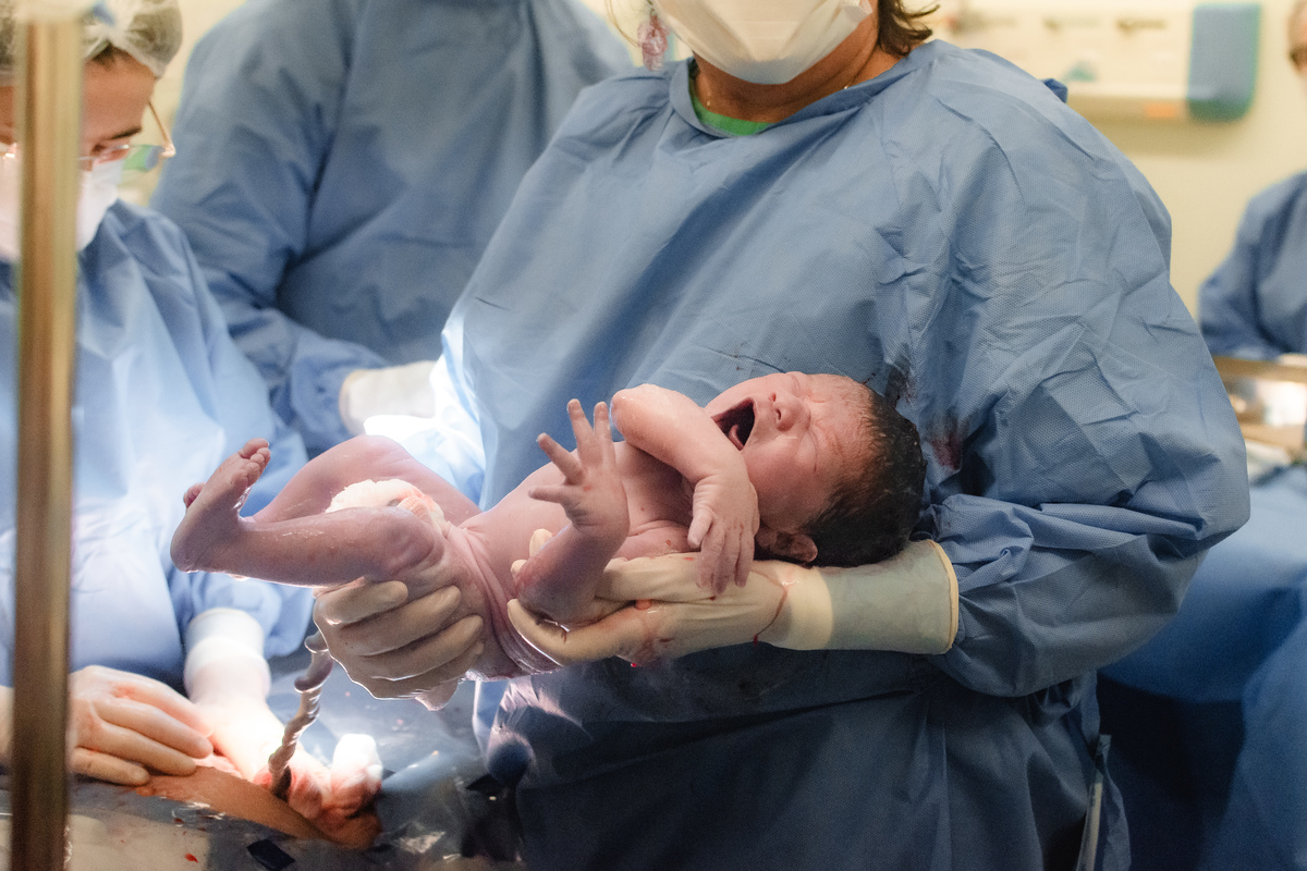 foto de parto em natal rn - o bebê nasceu