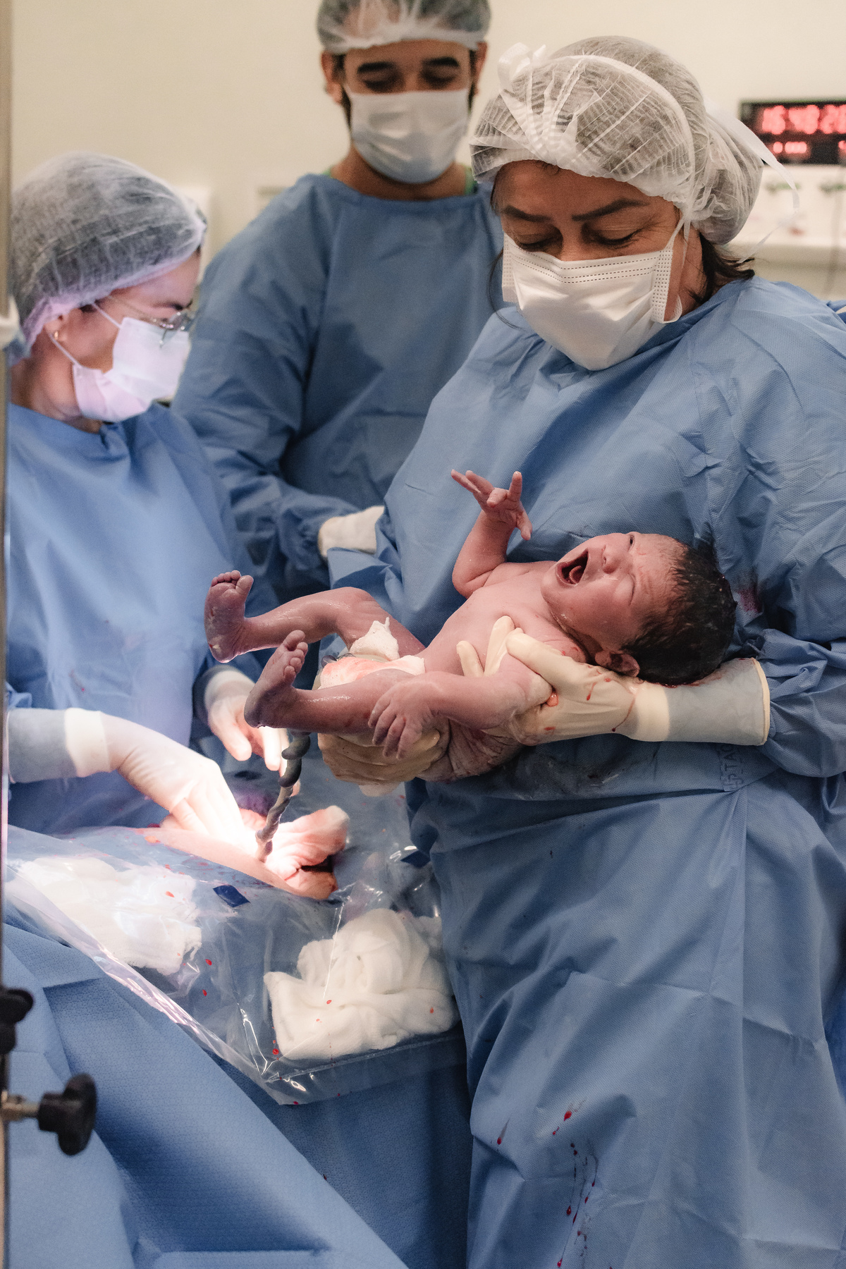 foto de parto em natal rn - o bebê nasceu