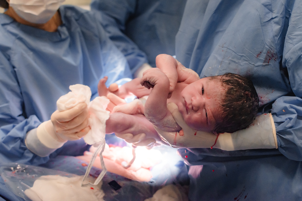 foto de parto em natal rn - o bebê nasceu