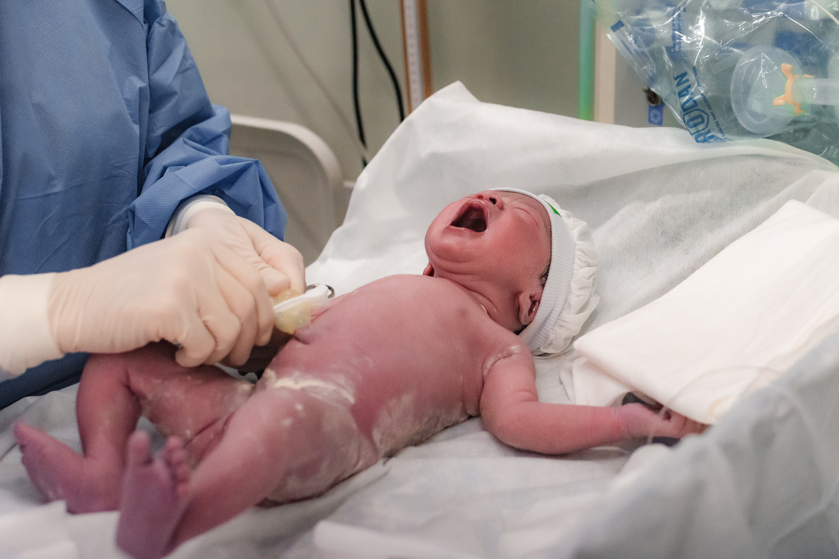 foto de parto em natal - os primeiros cuidados com o bebê