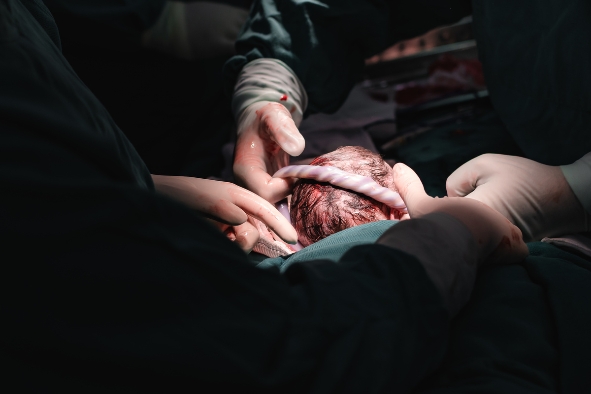 foto de parto por andré pontes - detalhe do nascimento imediato