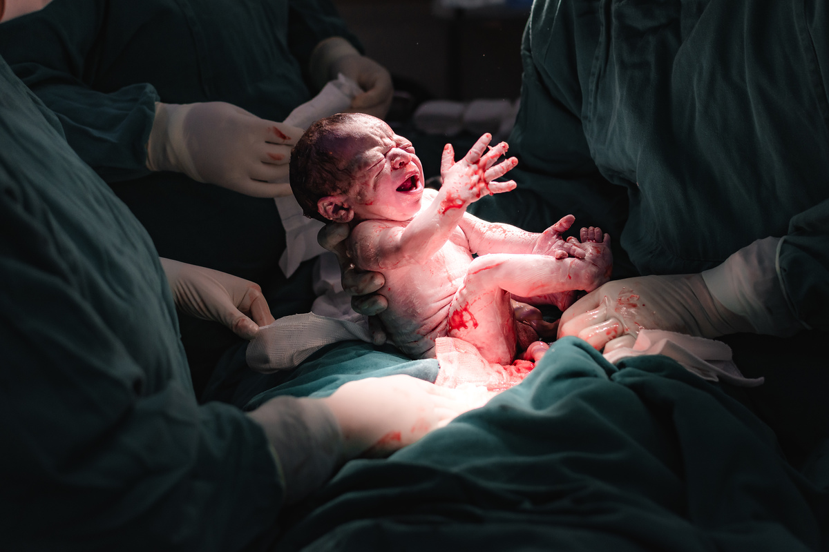 foto de parto por andré pontes - bebê veio à luz