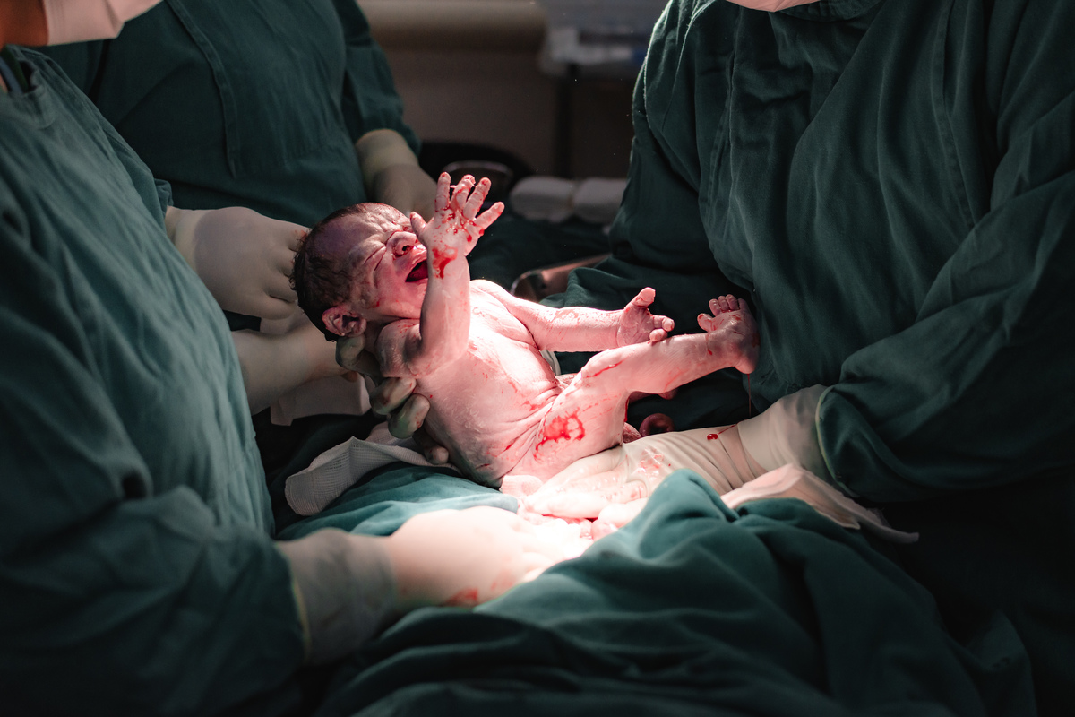 foto de parto por andré pontes - bebê veio à luz