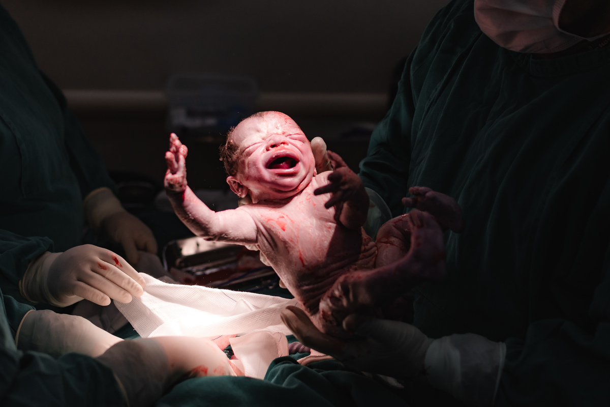 foto de parto por andré pontes - bebê veio à luz