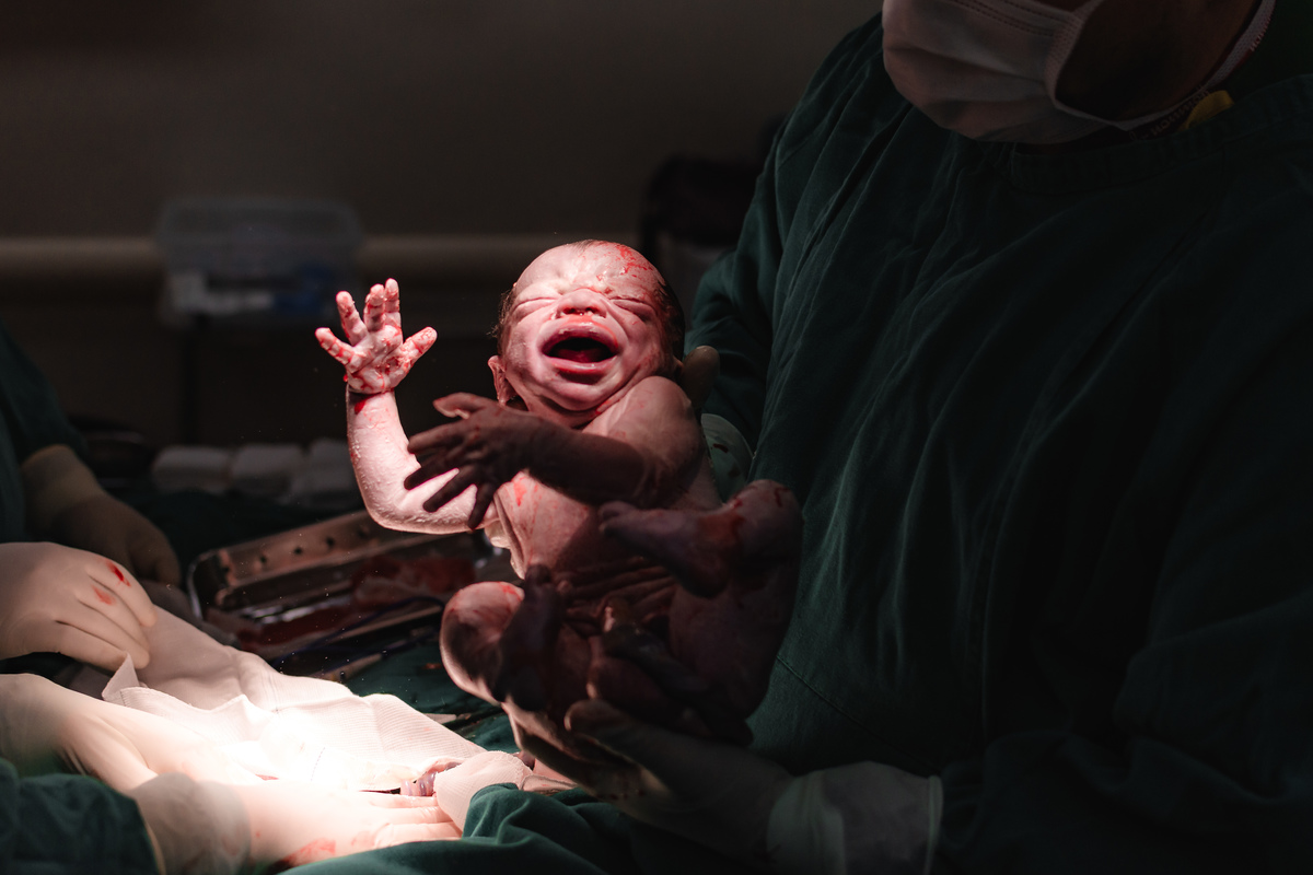 foto de parto por andré pontes - bebê veio à luz