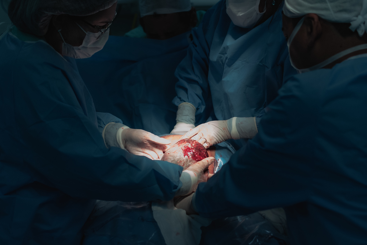 foto de parto em Natal por André Pontes - bebê vindo à luz