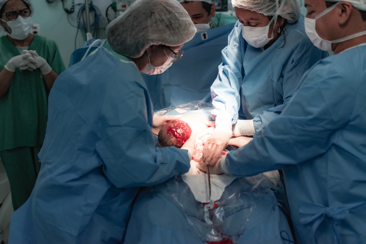 foto de parto em Natal por André Pontes - bebê vindo à luz