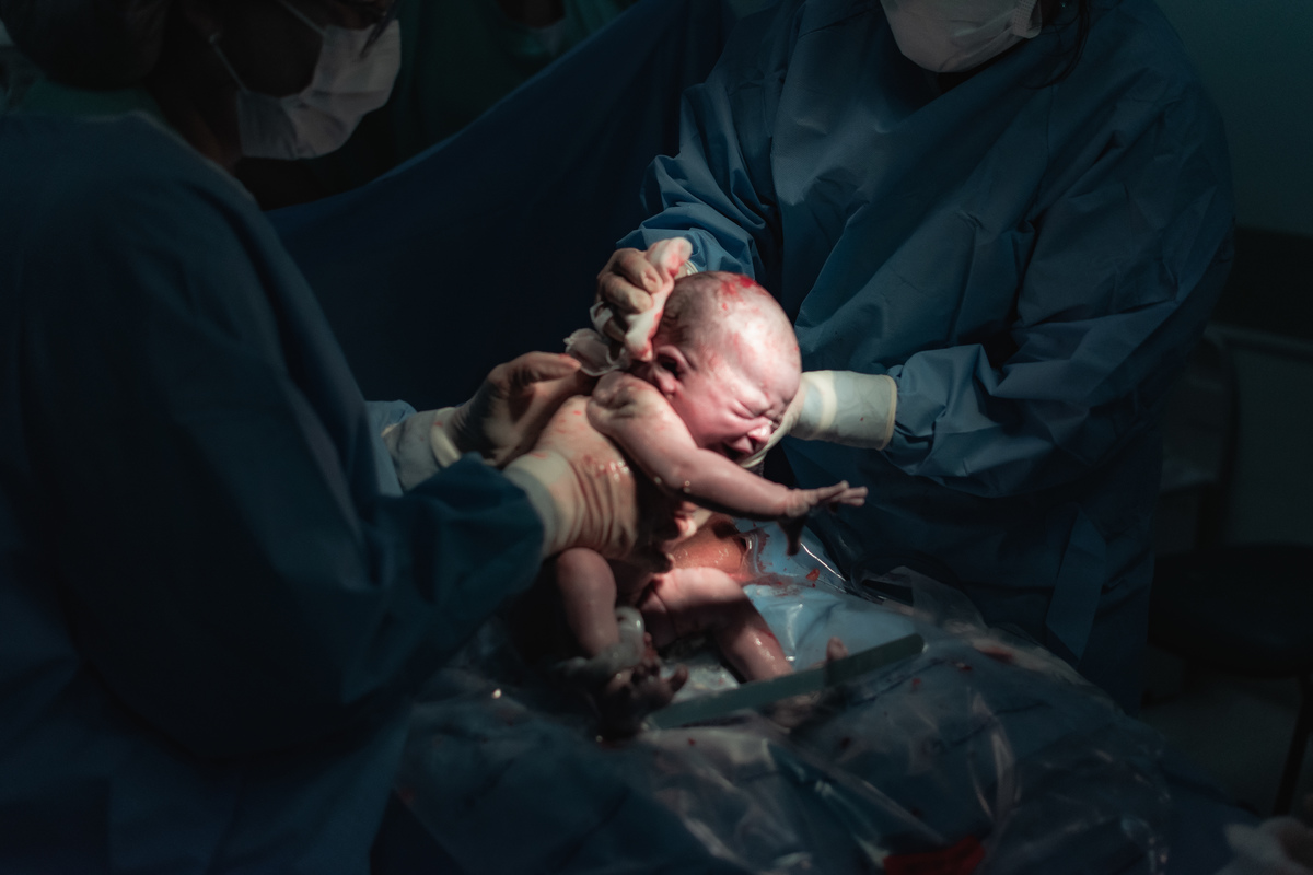 foto de parto em Natal por André Pontes - bebê vindo à luz