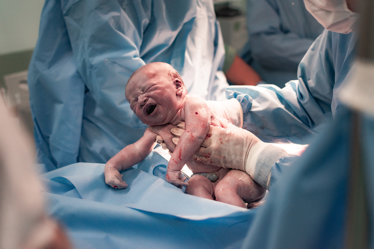 foto de parto em Natal por André Pontes - nasceu o bebê