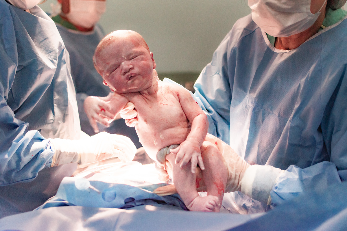foto de parto em Natal por André Pontes - nasceu o bebê