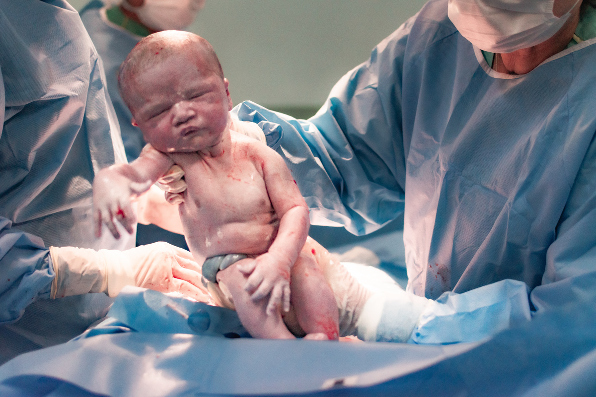 foto de parto em Natal por André Pontes - nasceu o bebê