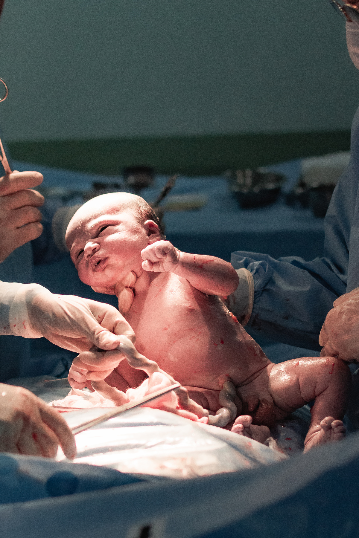 foto de parto em Natal por André Pontes - nasceu o bebê