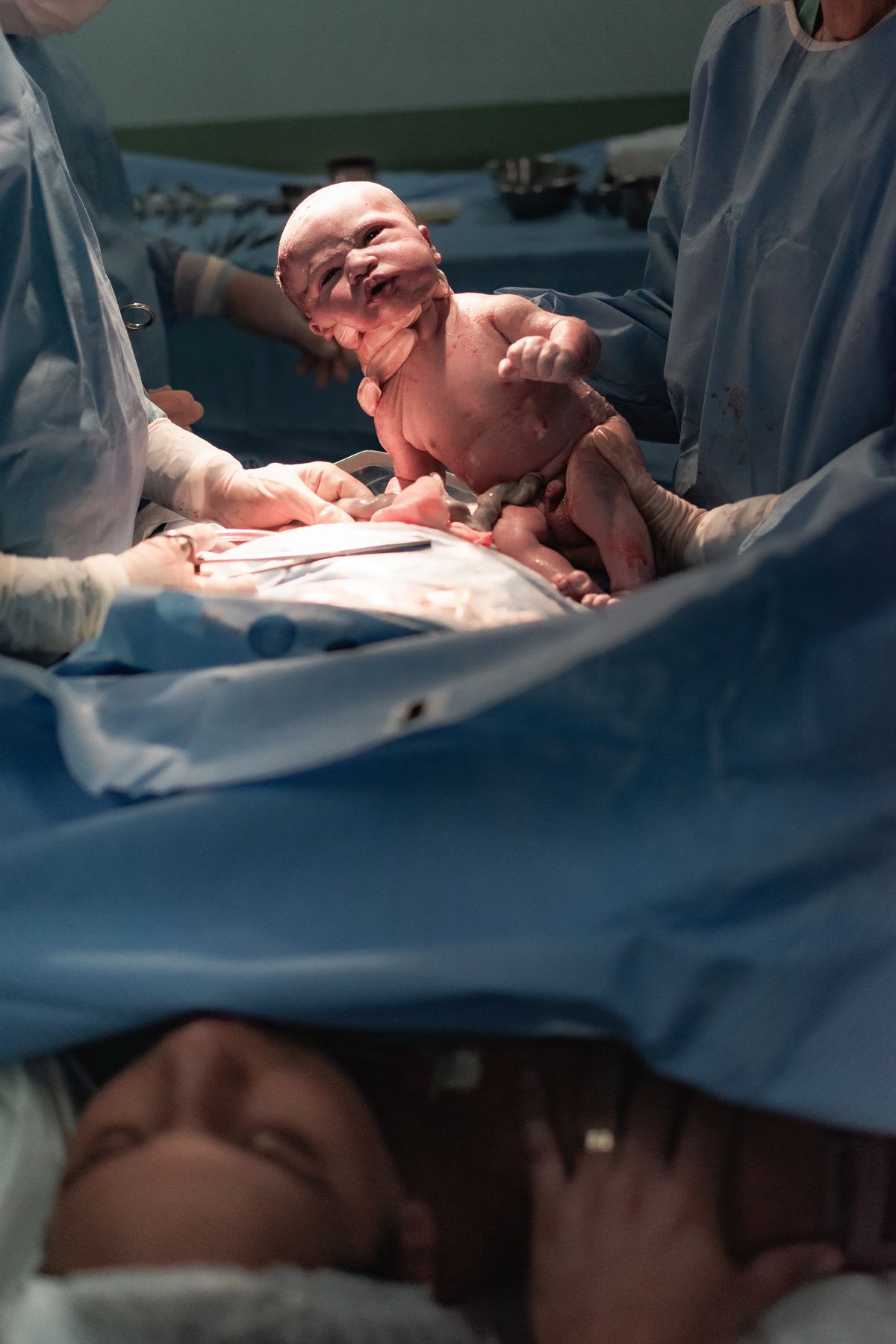 foto de parto em Natal por André Pontes - a primeira visão da mãe