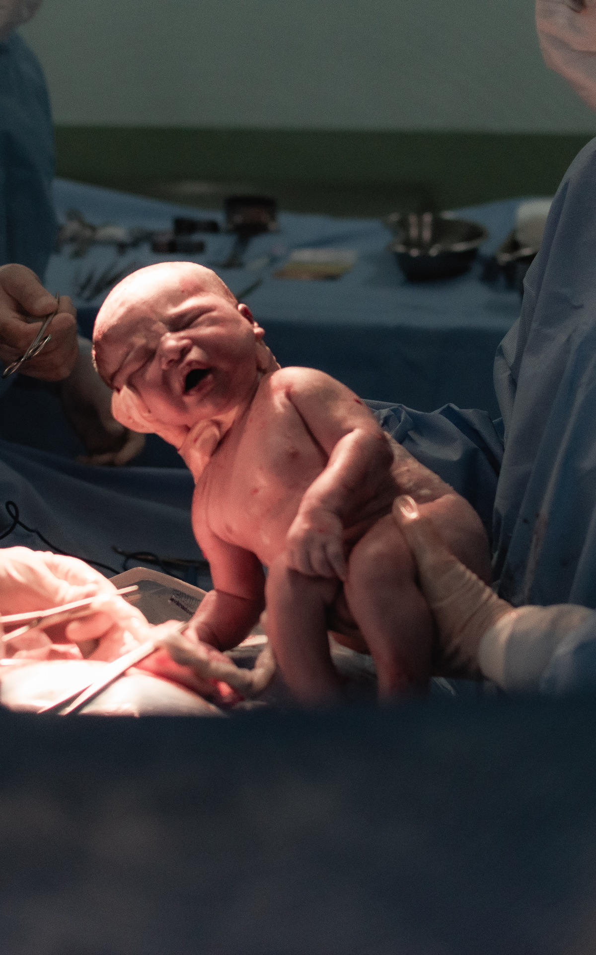 foto de parto em Natal por André Pontes - nasceu o bebê