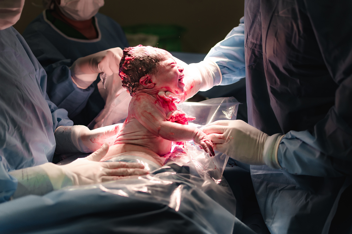 fotografia de parto pelo fotografo de parto andré pontes - o bebê nasceu