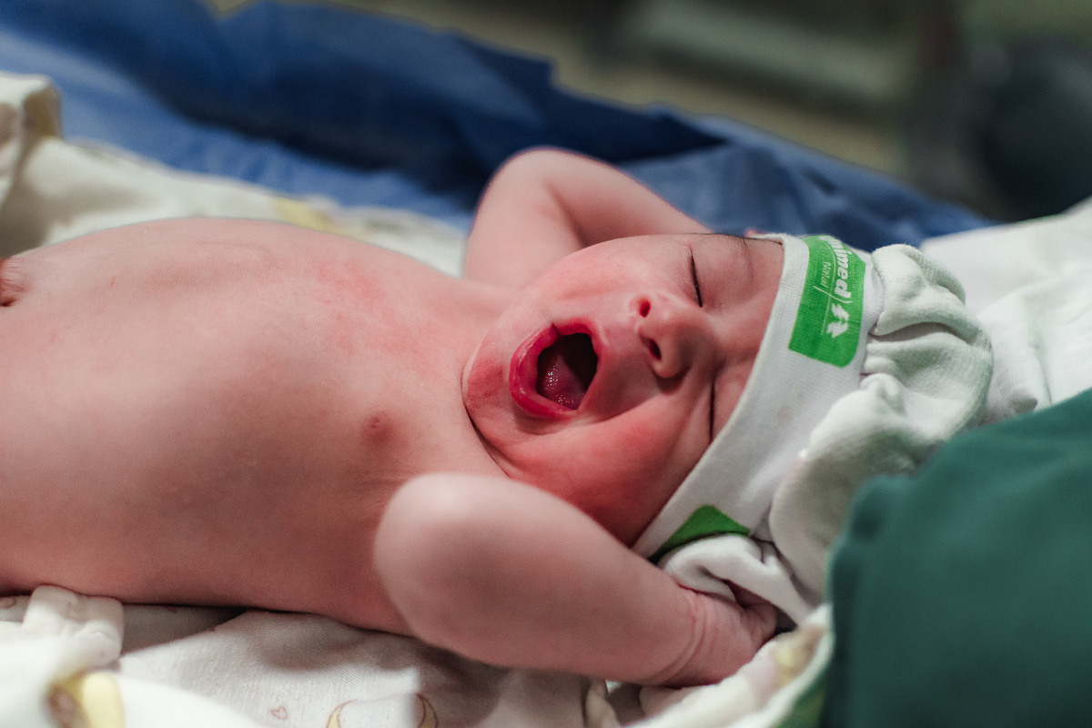 fotografia de parto pelo fotografo de parto andré pontes - bebê reagindo ao mundo