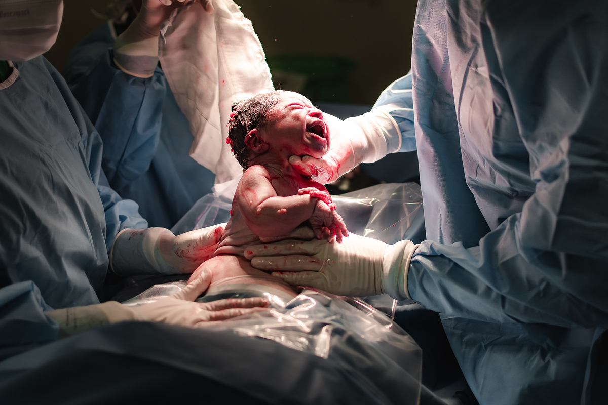 fotografia de parto pelo fotografo de parto andré pontes - o bebê nasceu