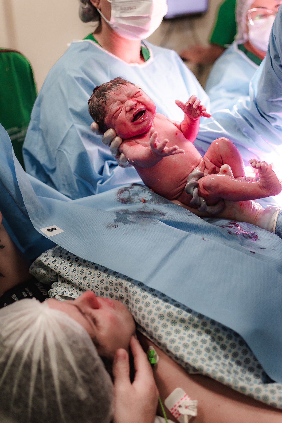 fotografia de parto pelo fotografo de parto andré pontes - mãe vendo o bebê pela primeira vez