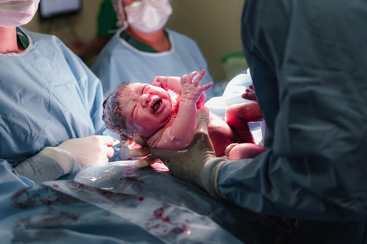 fotografia de parto pelo fotografo de parto andré pontes - o bebê nasceu