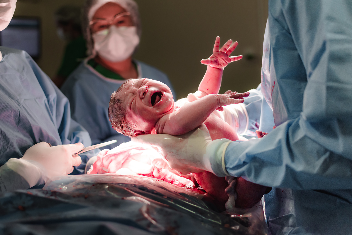 fotografia de parto pelo fotografo de parto andré pontes - o bebê nasceu