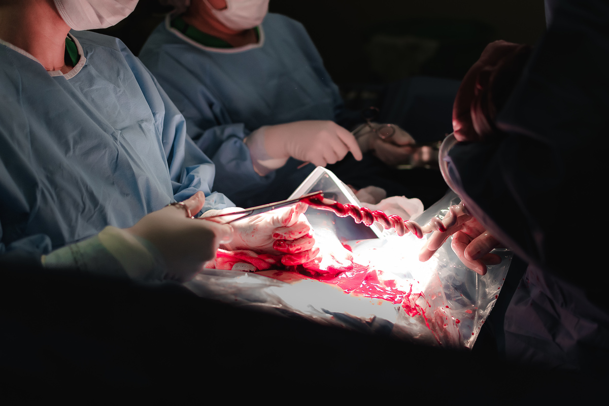 fotografia de parto pelo fotografo de parto andré pontes - corte do cordão umbilical