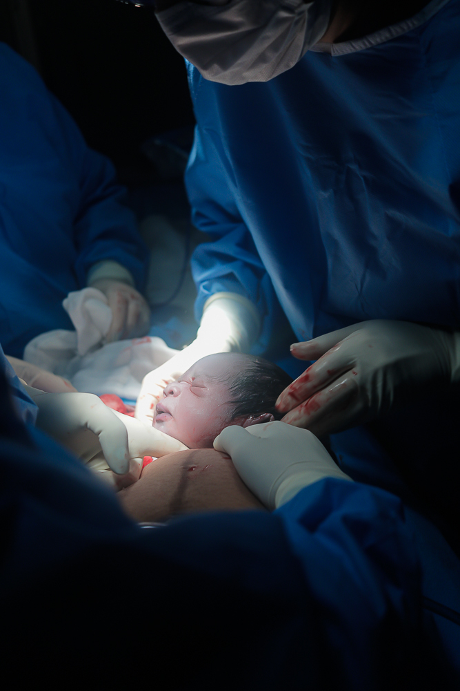 Fotografia de Parto - Niterói - Rj