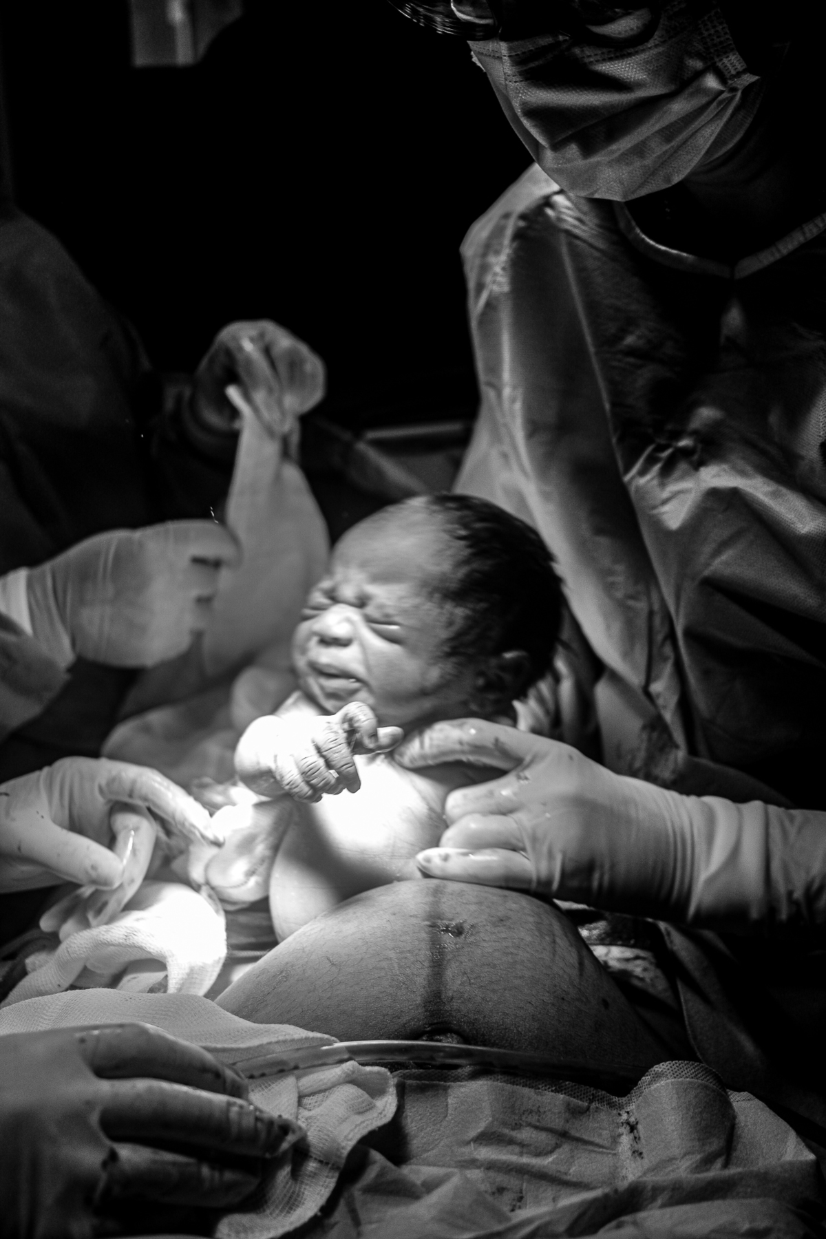 Fotografia de Parto - Niterói - Rj