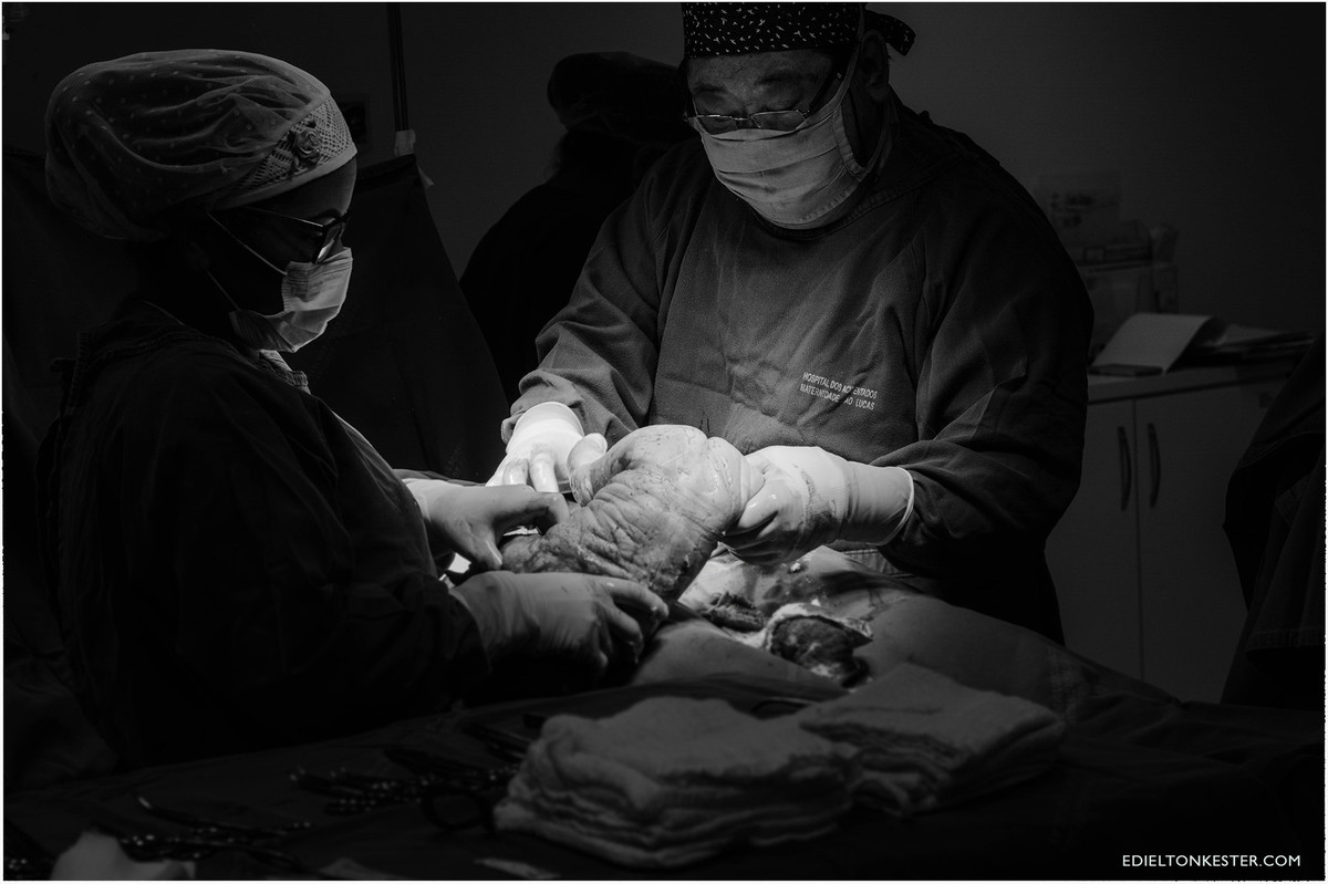 nascimento, bebes, bebe, parto, gravidas, gravida, gestação, gestante, gestantes, fotos de parto, fotos de gestantes, edielton kester, fotografos ro