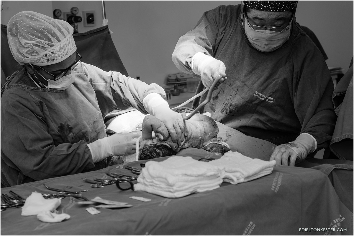 nascimento, bebes, bebe, parto, gravidas, gravida, gestação, gestante, gestantes, fotos de parto, fotos de gestantes, edielton kester, fotografos ro