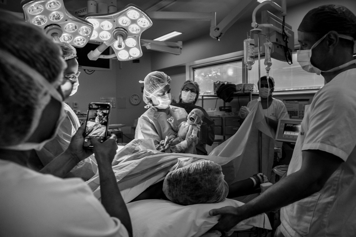 obstetra mostra bebe à mae na cesariana