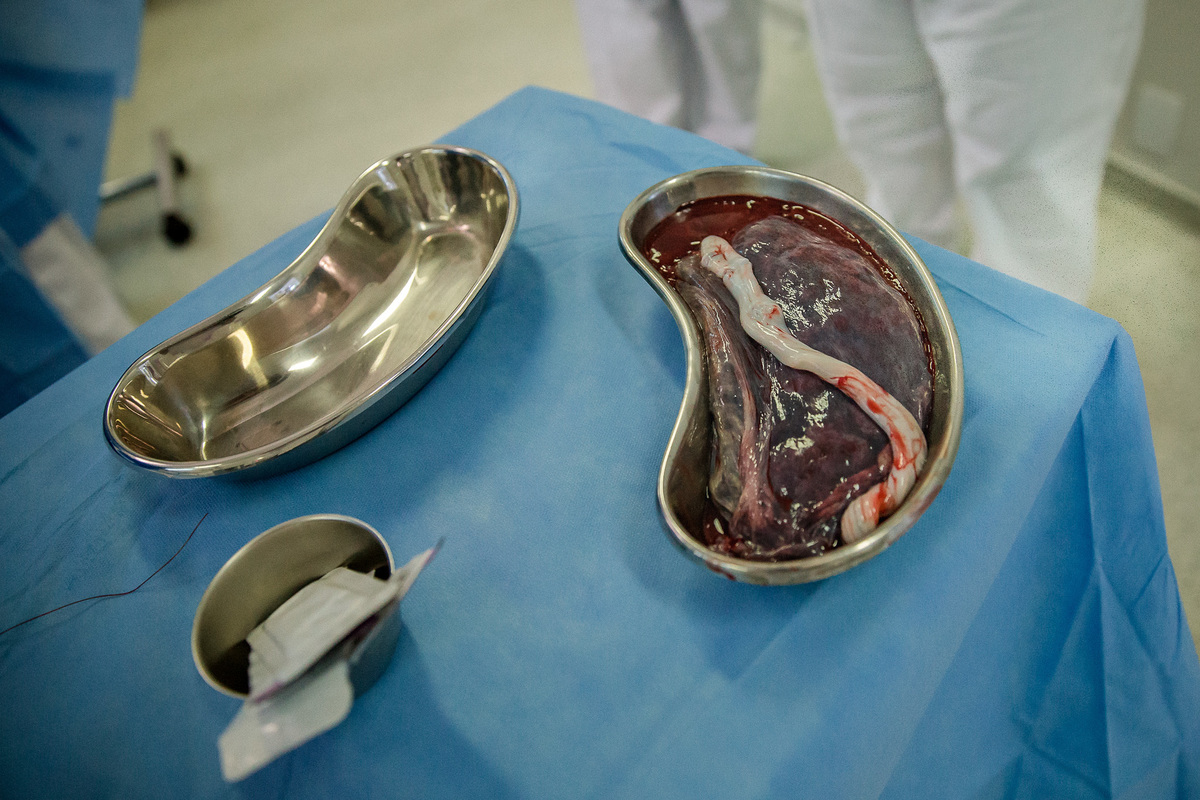 foto da placenta