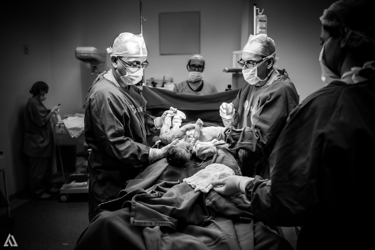 Fotografia de Parto Alex Jardim Fotografia Fotógrafo iapbp cesarean maternidade Resende Itatiaia Penedo Porto Real Quatis Barra Mansa Volta Redonda Serrinha do Alambari Hospital Samer
