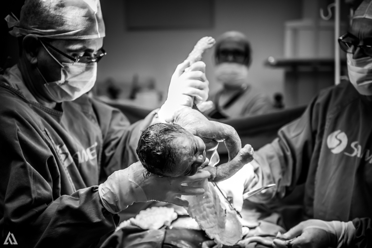 Fotografia de Parto Alex Jardim Fotografia Fotógrafo iapbp cesarean maternidade Resende Itatiaia Penedo Porto Real Quatis Barra Mansa Volta Redonda Serrinha do Alambari Hospital Samer