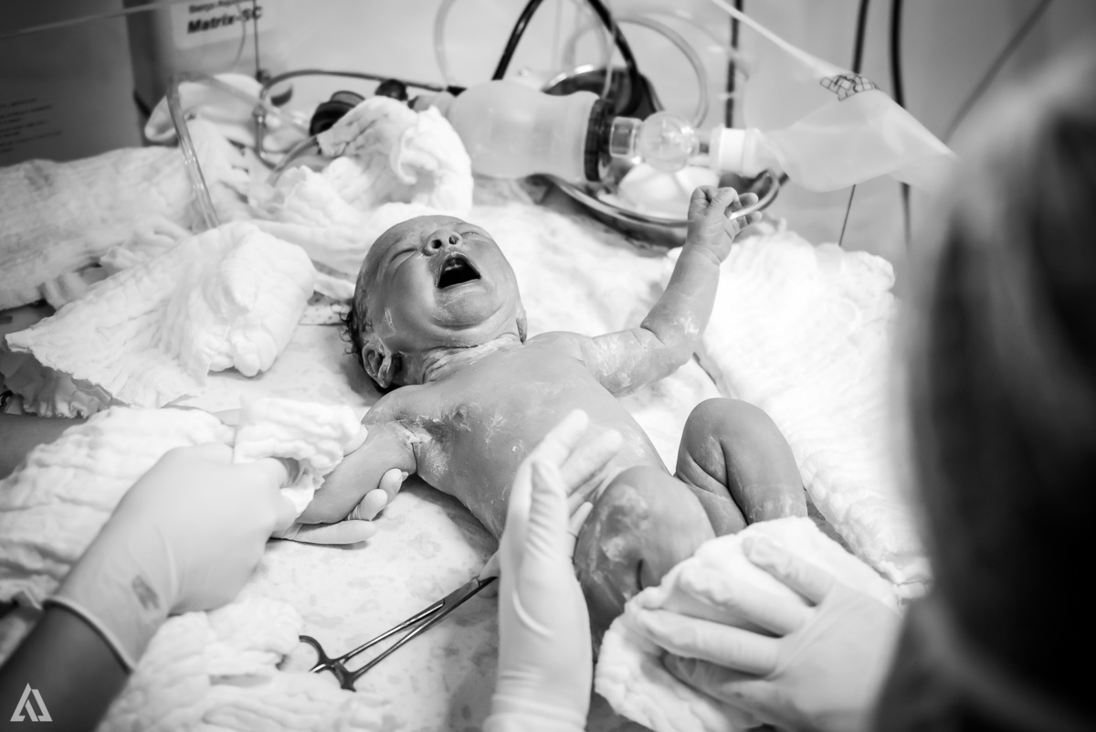 Fotografia de Parto Alex Jardim Fotografia Fotógrafo iapbp cesarean maternidade Resende Itatiaia Penedo Porto Real Quatis Barra Mansa Volta Redonda Serrinha do Alambari Hospital Samer