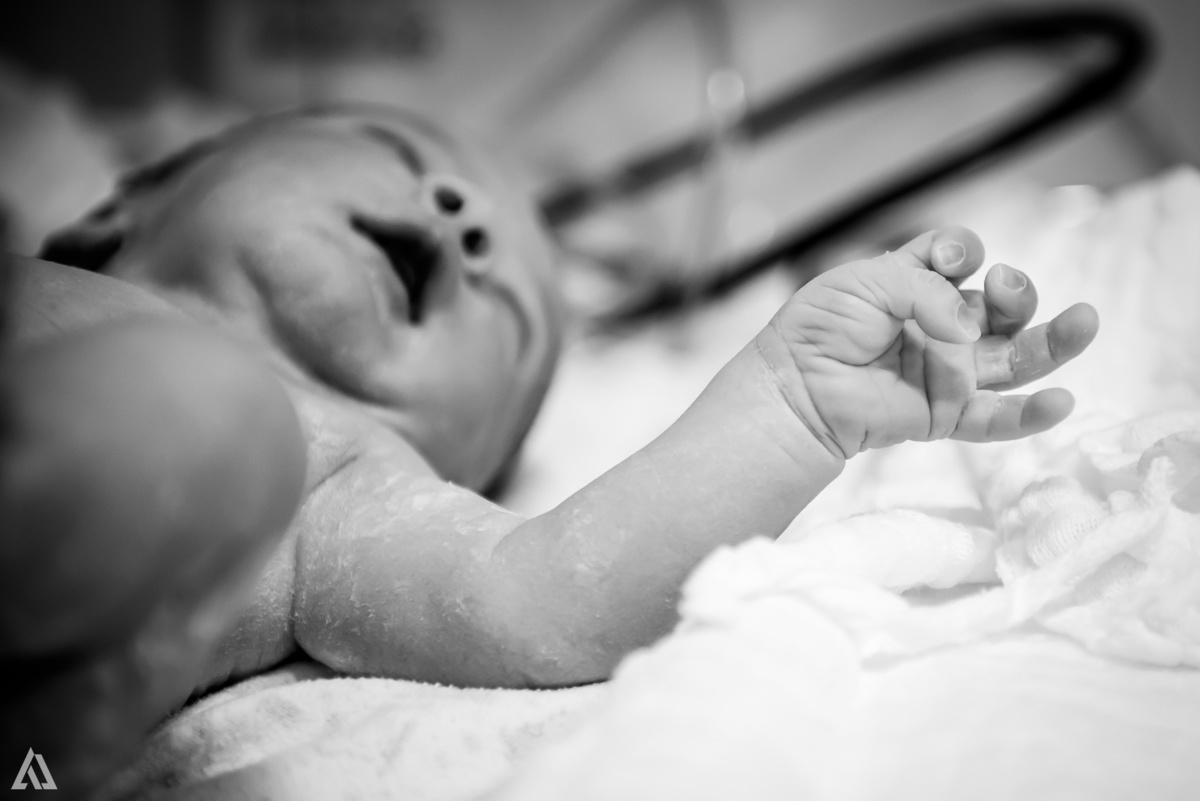 Fotografia de Parto Alex Jardim Fotografia Fotógrafo iapbp cesarean maternidade Resende Itatiaia Penedo Porto Real Quatis Barra Mansa Volta Redonda Serrinha do Alambari Hospital Samer