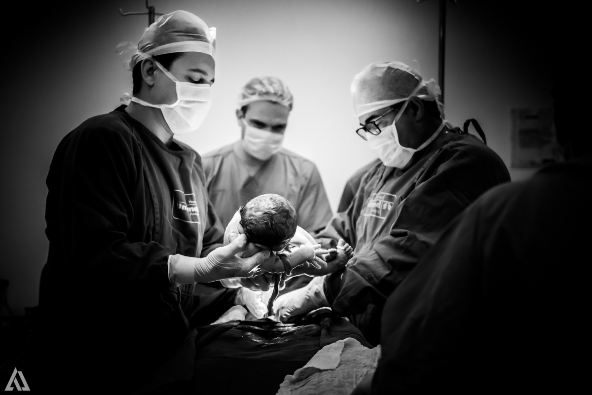 Fotografia de Parto Alex Jardim Fotografia Fotógrafo iapbp cesarean maternidade Resende Itatiaia Penedo Porto Real Quatis Barra Mansa Volta Redonda Serrinha do Alambari Hospital Unimed