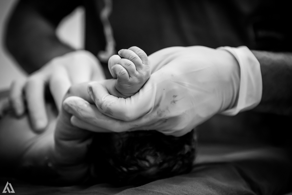 Fotografia de Parto Alex Jardim Fotografia Fotógrafo iapbp cesarean maternidade Resende Itatiaia Penedo Porto Real Quatis Barra Mansa Volta Redonda Serrinha do Alambari Hospital Unimed