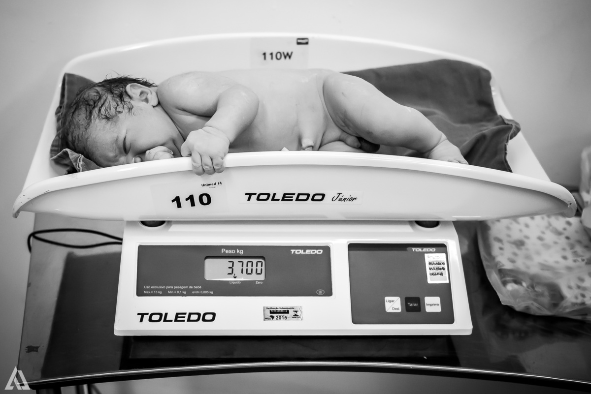 Fotografia de Parto Alex Jardim Fotografia Fotógrafo iapbp cesarean maternidade Resende Itatiaia Penedo Porto Real Quatis Barra Mansa Volta Redonda Serrinha do Alambari Hospital Unimed