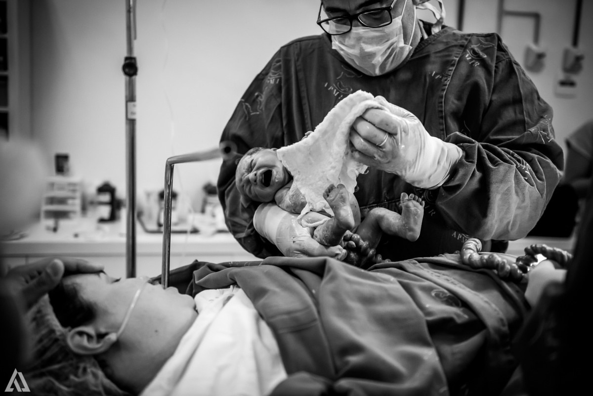 Fotografia de Parto Alex Jardim Fotografia Fotógrafo iapbp cesarean maternidade Resende Itatiaia Penedo Porto Real Quatis Barra Mansa Volta Redonda Serrinha do Alambari Hospital Maternidade APMIR