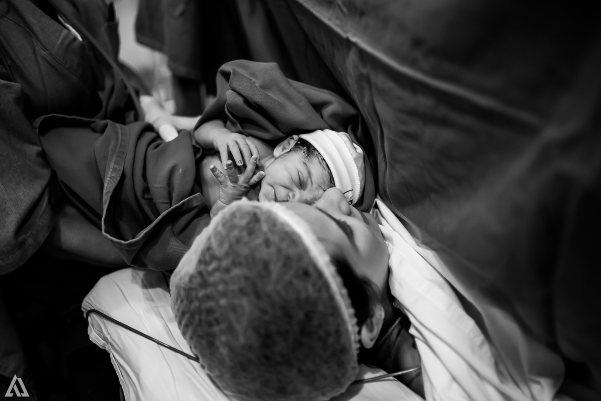 Fotografia de Parto Cesárea Normal Humanizado Alex Jardim Fotografia Fotógrafo iapbp cesarean maternidade Resende Itatiaia Penedo Porto Real Quatis Barra Mansa Volta Redonda Serrinha do Alambari Hospital Maternidade APMIR SAMER UNIMED