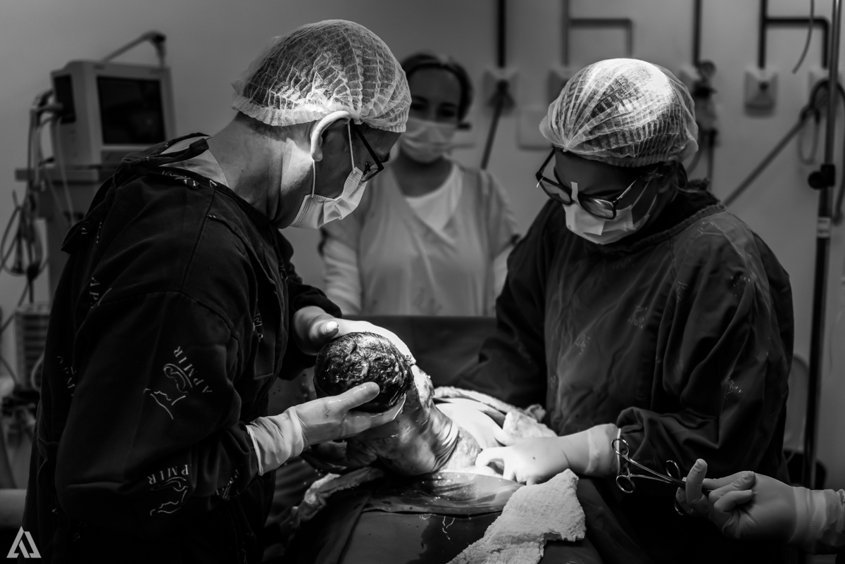 Fotografia de Parto Cesárea Normal Humanizado Alex Jardim Fotografia Fotógrafo iapbp cesarean maternidade Resende Itatiaia Penedo Porto Real Quatis Barra Mansa Volta Redonda Serrinha do Alambari Hospital Maternidade APMIR SAMER UNIMED HINJA