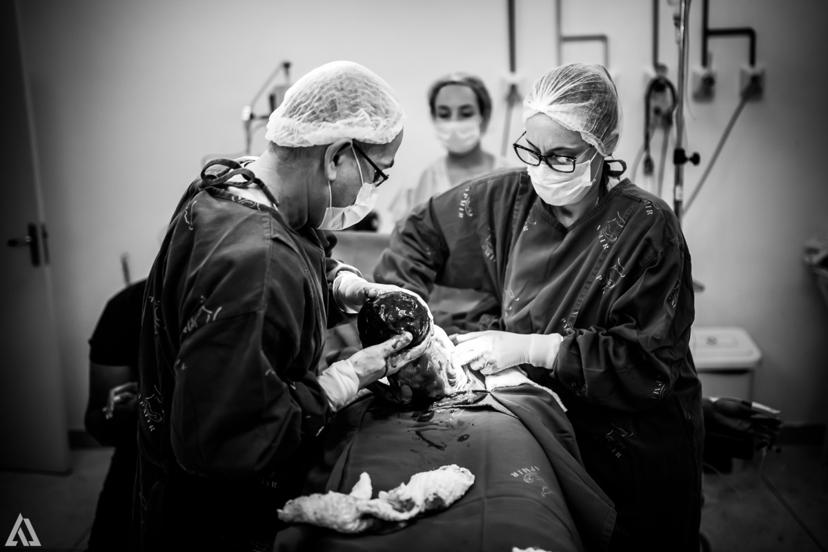 Fotografia de Parto Cesárea Normal Humanizado Alex Jardim Fotografia Fotógrafo iapbp cesarean maternidade Resende Itatiaia Penedo Porto Real Quatis Barra Mansa Volta Redonda Serrinha do Alambari Hospital Maternidade APMIR SAMER UNIMED