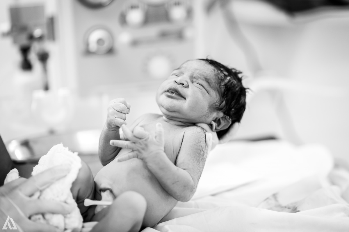 Fotografia de Parto Cesárea Normal Humanizado Alex Jardim Fotografia Fotógrafo iapbp cesarean maternidade Resende Itatiaia Penedo Porto Real Quatis Barra Mansa Volta Redonda Serrinha do Alambari Hospital Maternidade APMIR SAMER UNIMED