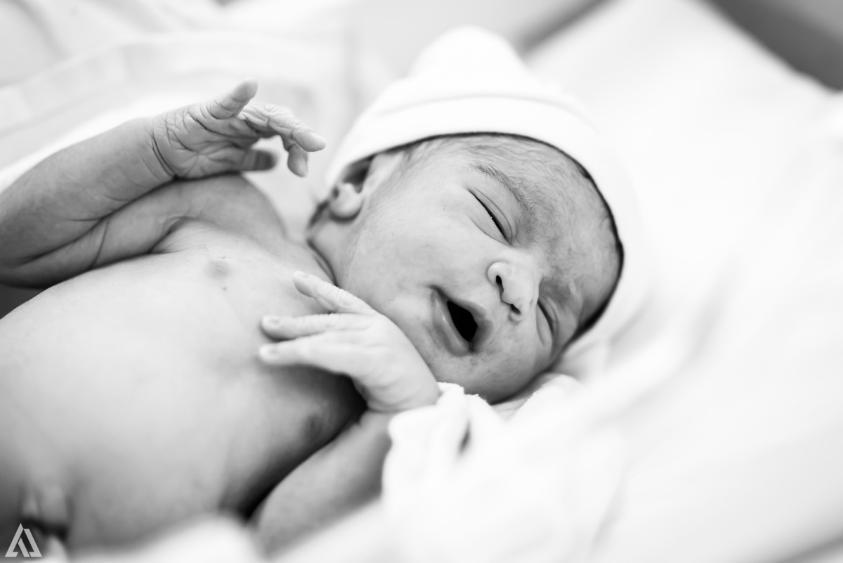 Fotografia de Parto Cesárea Normal Humanizado Alex Jardim Fotografia Fotógrafo iapbp cesarean maternidade Resende Itatiaia Penedo Porto Real Quatis Barra Mansa Volta Redonda Serrinha do Alambari Hospital Maternidade APMIR SAMER UNIMED