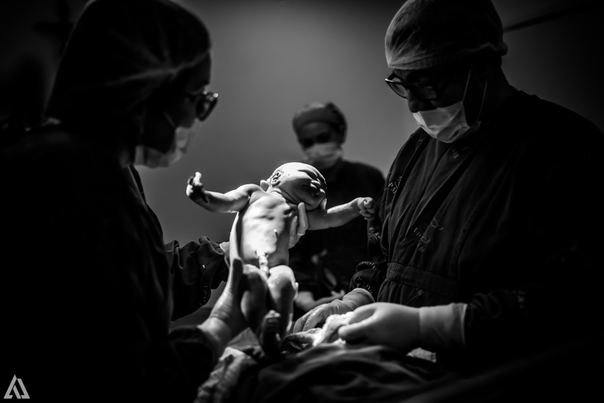 Fotografia de Parto Cesárea Normal Humanizado Alex Jardim Fotografia Fotógrafo iapbp cesarean maternidade Resende Itatiaia Penedo Porto Real Quatis Barra Mansa Volta Redonda Serrinha do Alambari Hospital Maternidade APMIR SAMER UNIMED